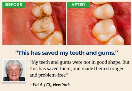 ProXental Customer Reviews